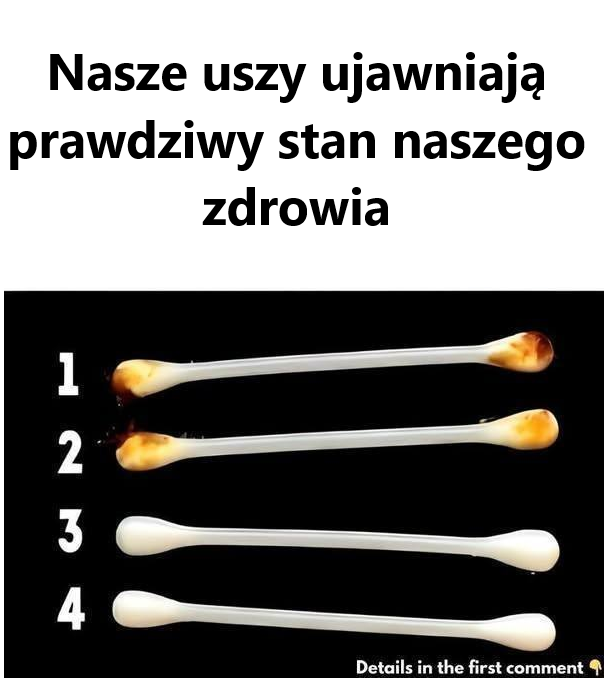 Nasze uszy ujawniają prawdziwy stan naszego zdrowia