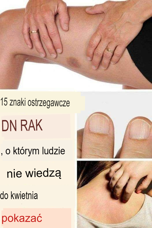 15 objawów raka, które ludzie ignorują, aż jest za późno