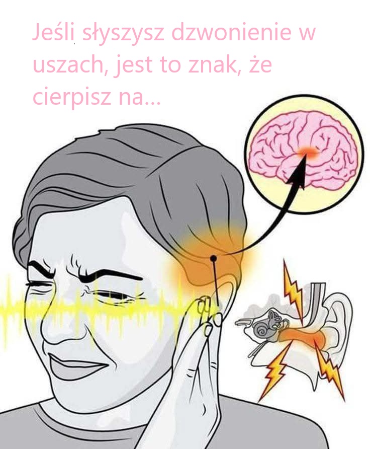 Czy szum w uszach to znak problemów zdrowotnych?