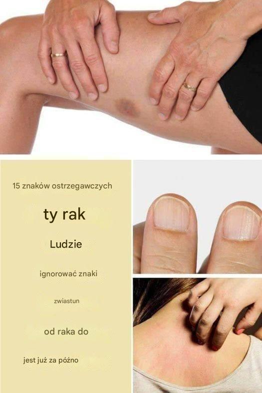 15 ostrzegawczych sygnałów raka, które ludzie ignorują, dopóki nie jest za późno