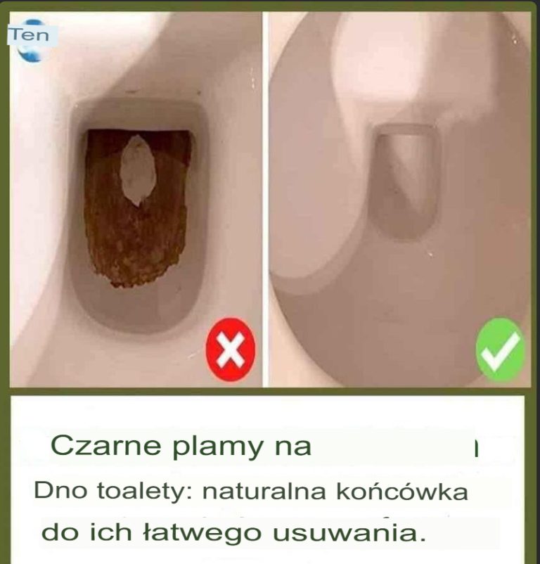 🚽 Jak Usunąć Czarny Osad w Toalecie? Naturalny Trik, Który Działa Bez Wysiłku!