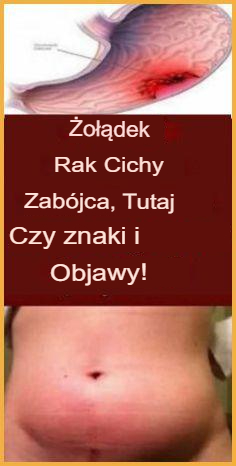 Rak Żołądka – Cichy Zabójca