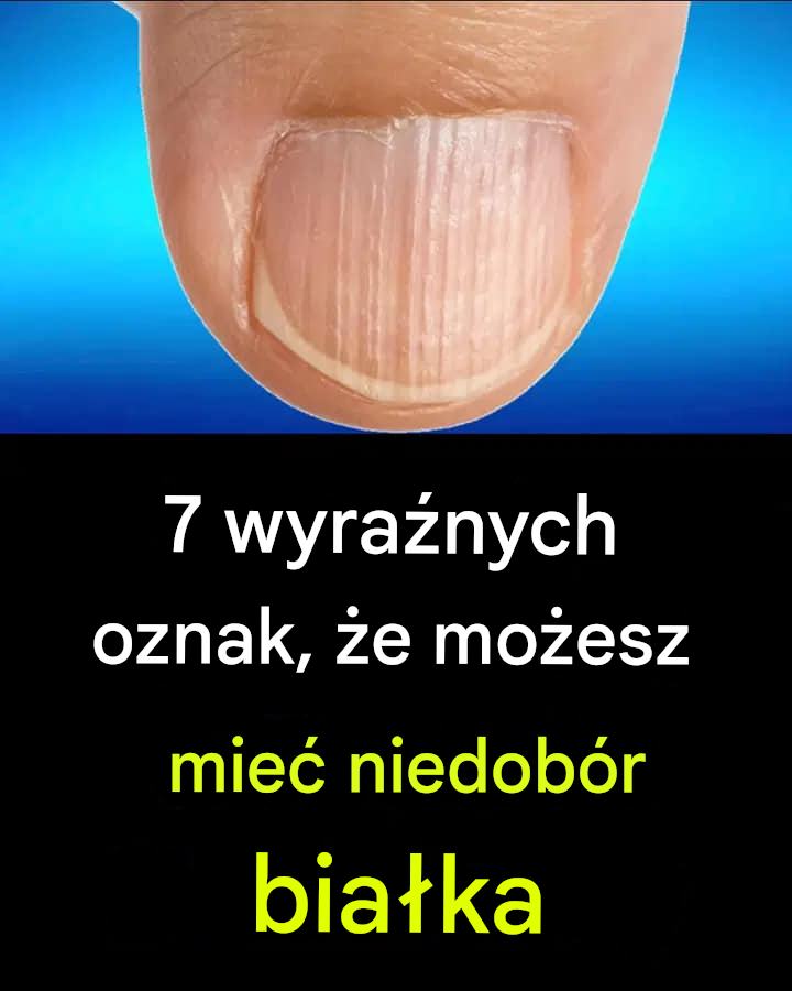 7 wyraźnych oznak, że możesz mieć niedobór białka