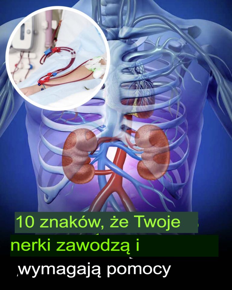 10 Oznak, Że Twoje Nerki Są Zagrożone! Nie Ignoruj Tych Sygnałów