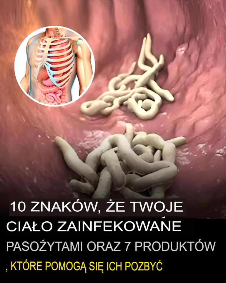 10 Oznak, Że Twój Organizm Jest Pełen Pasożytów