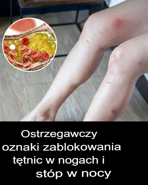 Co Twoje Stopy Mówią o Zdrowiu Twojego Serca?