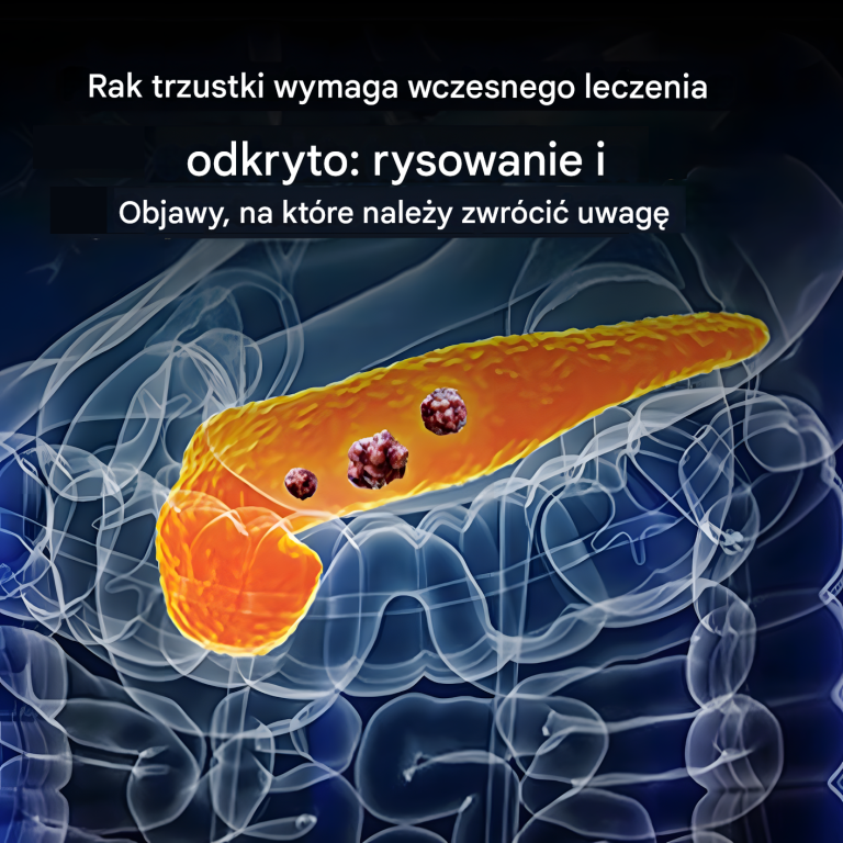 10 objawów raka trzustki, których nie należy ignorować