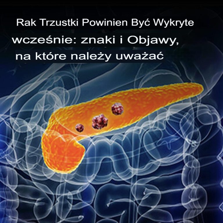 10 objawów raka trzustki, których nie należy ignorować