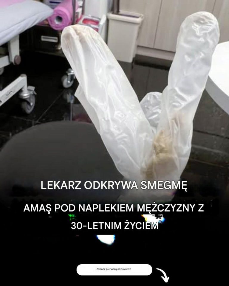 Lekarz odkrył smegmę pod napletkiem u żonatego mężczyzny, który od 30 lat cierpiał na nieznośny ból