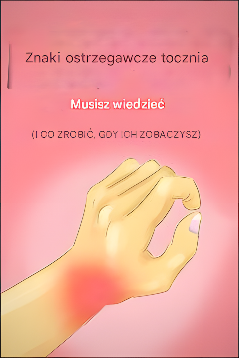 Rozpoznawanie sygnałów ostrzegawczych: 8 wczesnych objawów tocznia