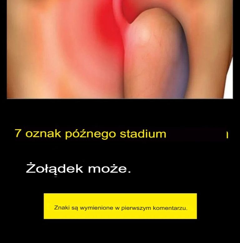 7 objawów zaawansowanego raka żołądka