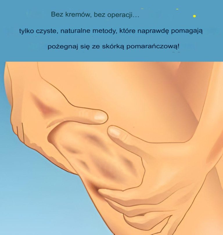 7 wskazówek, jak naturalnie pozbyć się cellulitu w domu