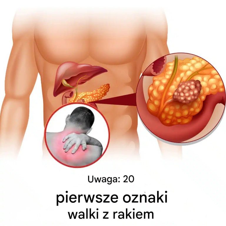 20 wczesnych sygnałów ostrzegawczych, jeśli Twój organizm walczy z malatią