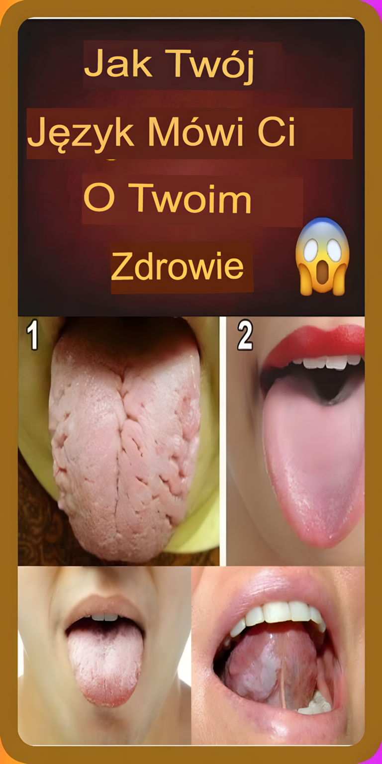 Co Twój język mówi o toksynach w Twoim organizmie