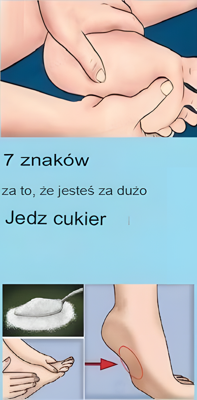 7 oznak, że jesz za dużo cukru