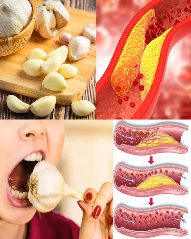 Codzienne spożywanie surowego czosnku: naturalny sposób na wsparcie zdrowia serca i obniżenie poziomu cholesterolu