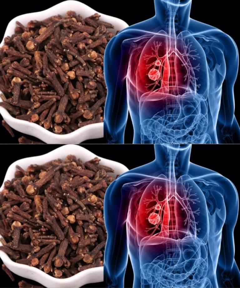 Lepsze oddychanie w naturalny sposób: jak goździki mogą pomóc w walce z infekcjami dróg oddechowych i zapaleniem oskrzeli