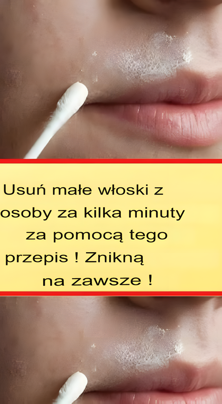 Ta naturalna receptura na stałe usunie włoski z twarzy