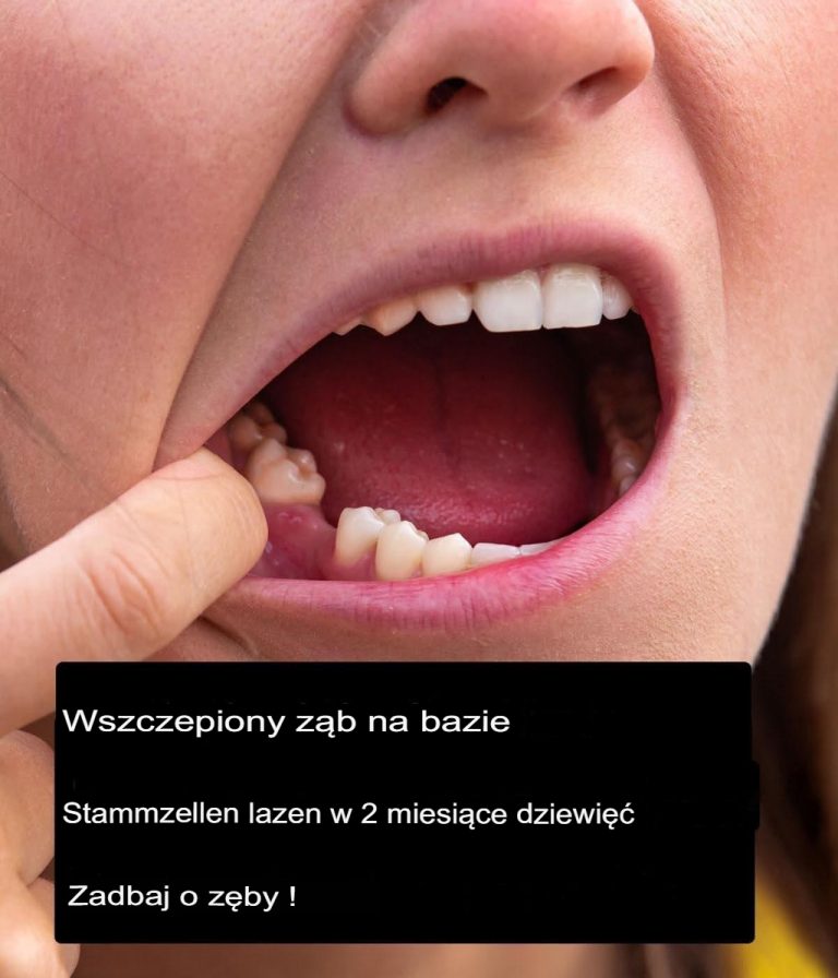 Implanty stomatologiczne na bazie komórek macierzystych mogą w przyszłości zastąpić protezy zębowe