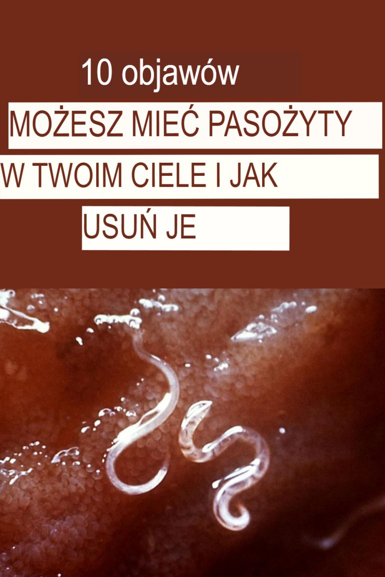 10 nietypowych objawów raka jelita grubego