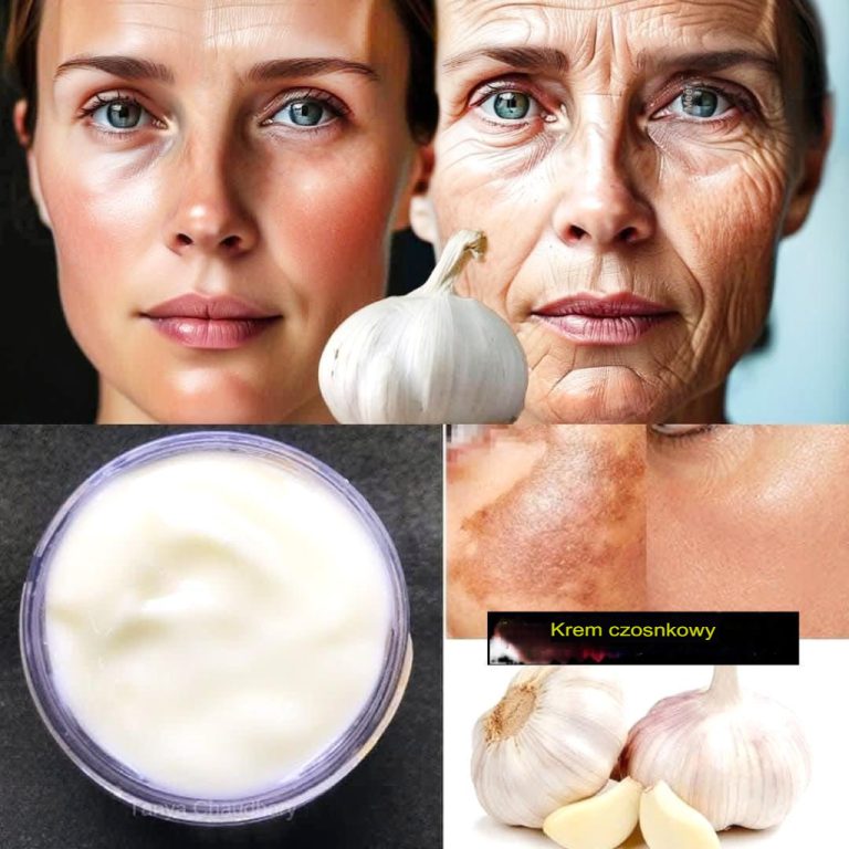 Collagen Boost: produkt czosnkowy przeciwzmarszczkowy, który działa nawet w wieku 70 lat!