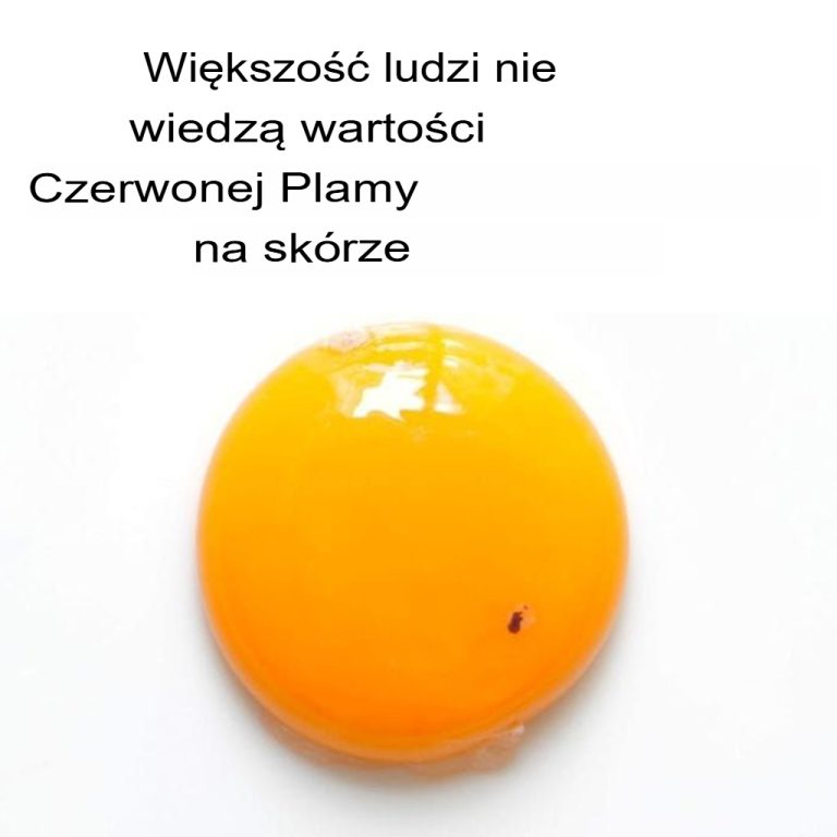 Oto co oznacza, gdy jajko zawiera czerwoną plamkę