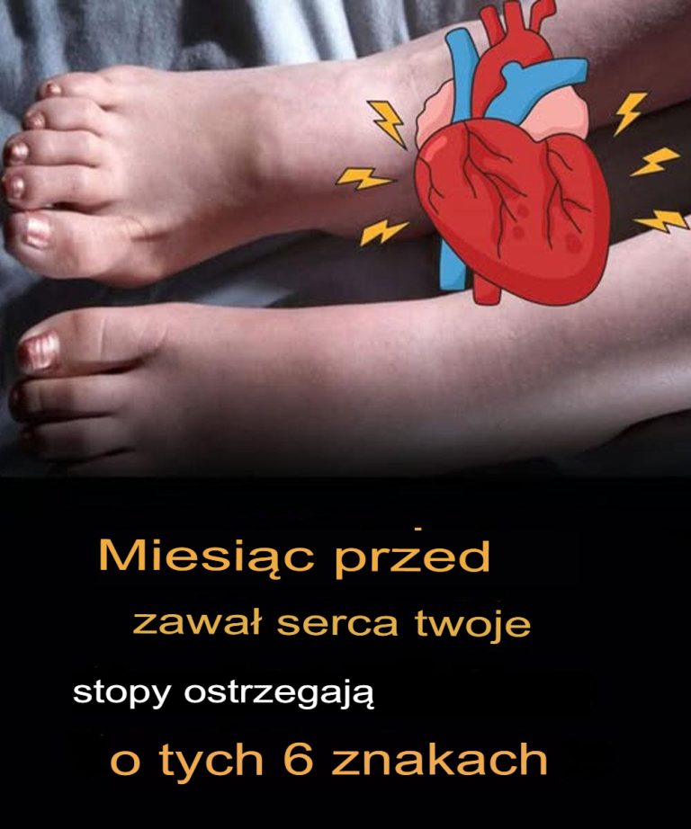 Miesiąc przed zawałem serca Twoje stopy ostrzegają Cię przed tymi 6 objawami