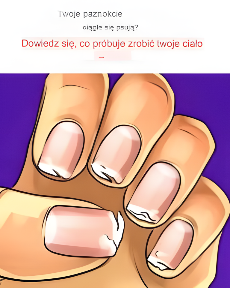 Czy Twoje paznokcie ciągle pękają lub się rozdwajają? To sygnał, który próbuje Ci wysłać Twoje ciało.