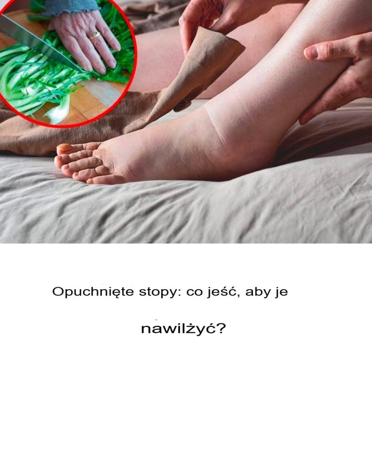 Zatrzymanie płynów: jakie są jego przyczyny i jak sobie z nim poradzić?