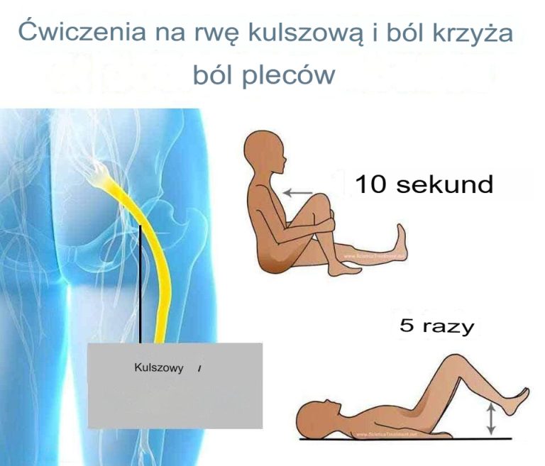 Ćwiczenia na rwę kulszową