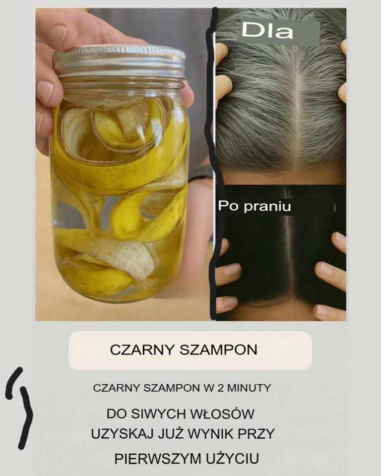 Zaskakujący naturalny sposób na przyciemnienie siwych włosów za pomocą skórek bananowych