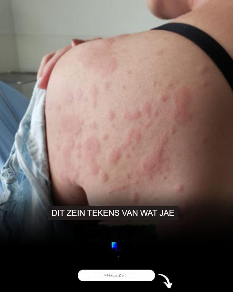 Pokrzywka? Alergia? Całe ciało ją swędziało, a lekarze postawili najgorszą diagnozę.