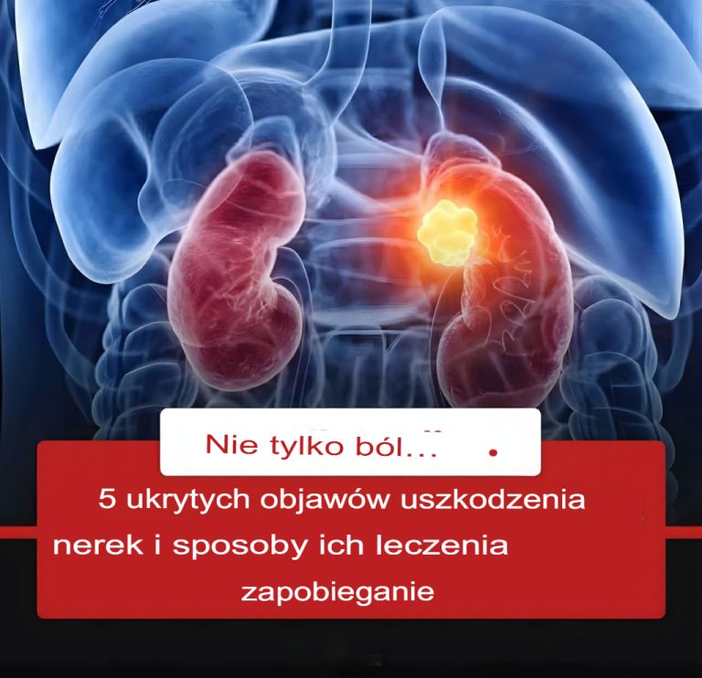 Ciche objawy uszkodzenia nerek i metody zapobiegania