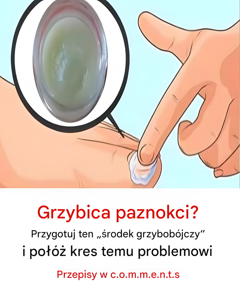Grzybica paznokci? Przygotuj ten „środek na grzyby” i połóż kres temu problemowi