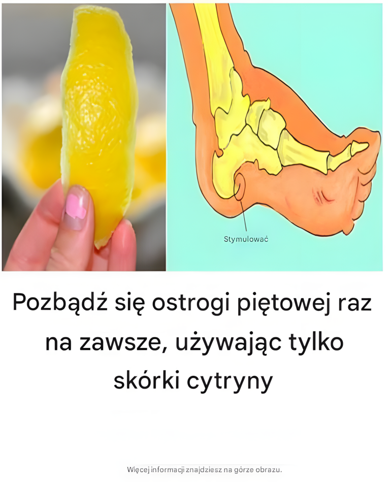 Naturalny sposób na ostrogę piętową: Terapia z użyciem skórki cytrynowej