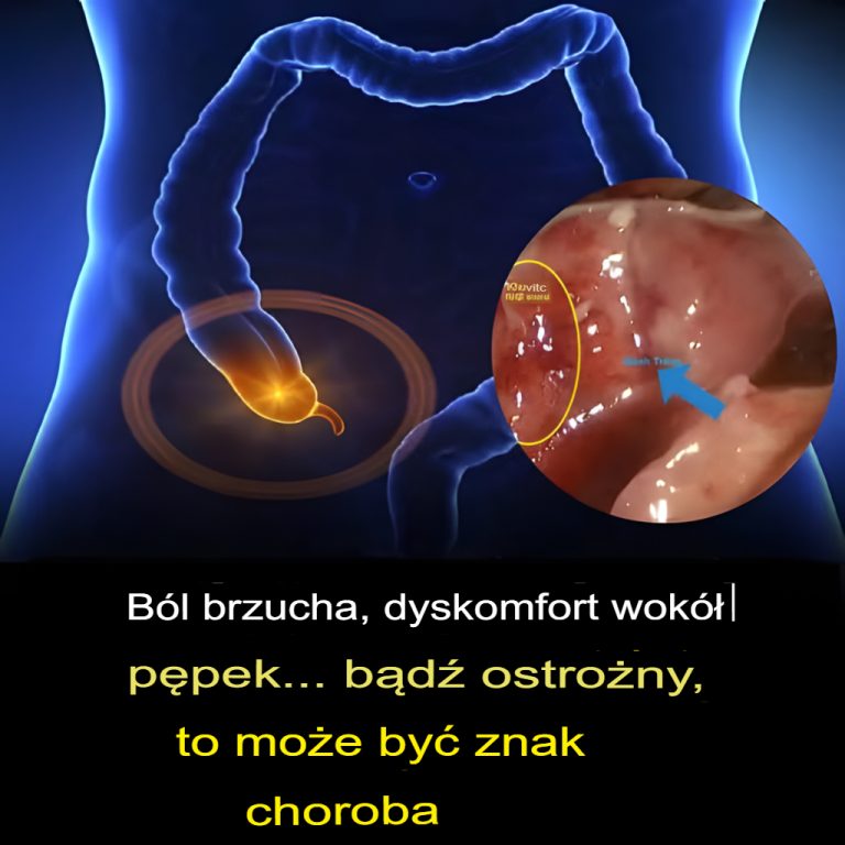 Tępy ból brzucha, ból brzucha w okolicy pępka? Oto, co musisz wiedzieć.