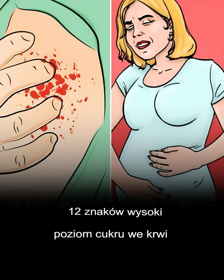 12 oznak, że masz wysoki poziom cukru we krwi