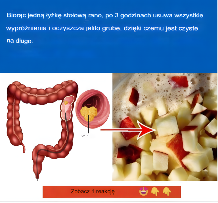 Zaparcia: Oto 3 naturalne sposoby, które ułatwiają wypróżnianie, według dietetyka