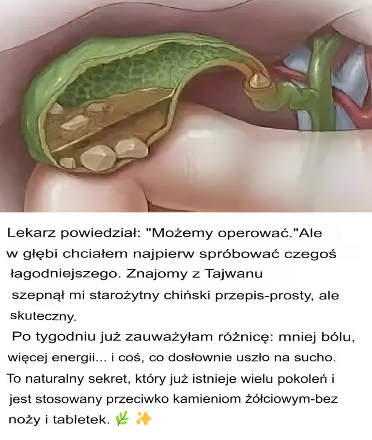 Chiński przepis na naturalne usuwanie kamieni żółciowych