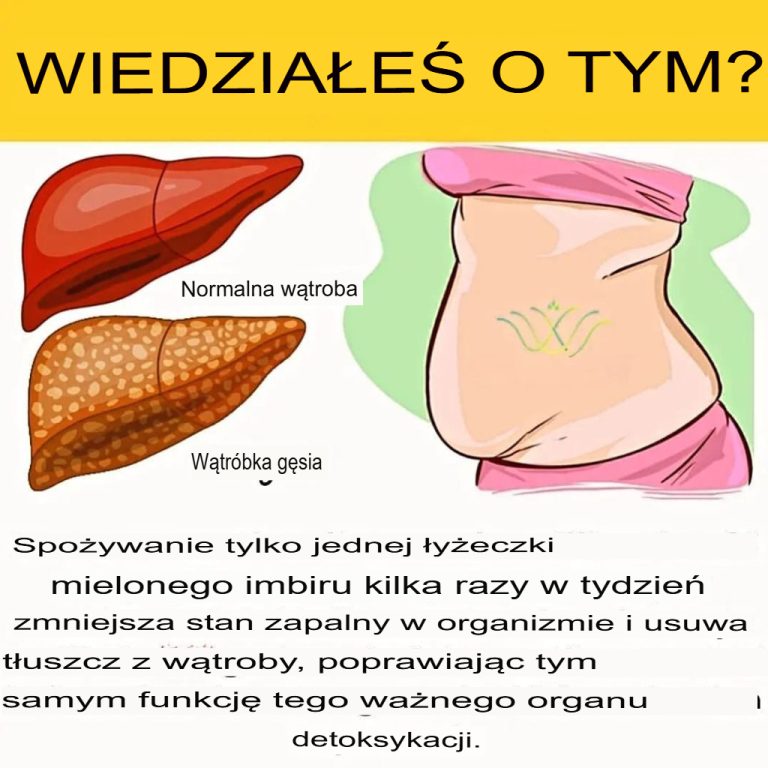 6 oznak, że Twoja wątroba jest pełna toksyn i powoduje otyłość (i jak temu zaradzić)