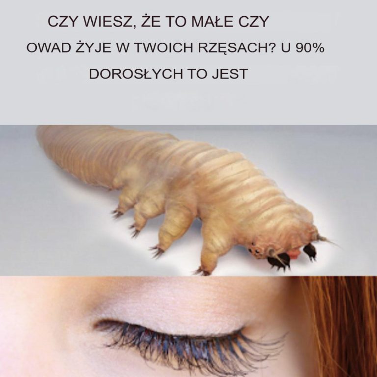 Czy wiesz, że ten owad żyje w rzęsach? Dotyczy 90% dorosłych osobników.