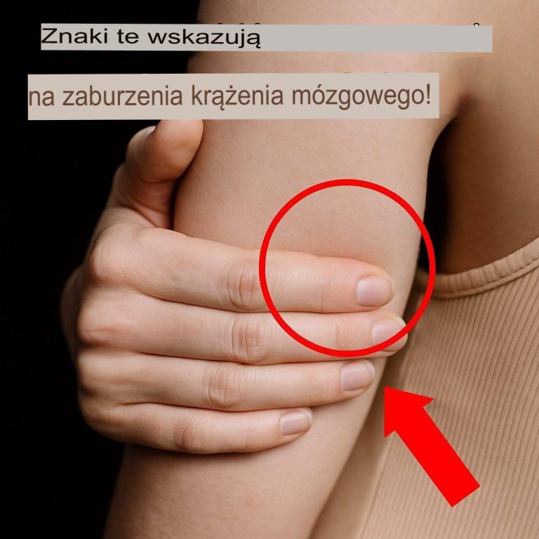 Czy to zmęczenie, czy udar? Kobiety nie powinny ignorować tych sygnałów ostrzegawczych.