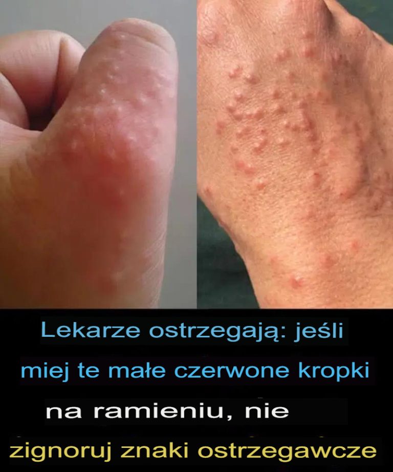 Nie ignoruj tych małych czerwonych plamek na ramieniu – mogą być ważnymi znakami ostrzegawczymi