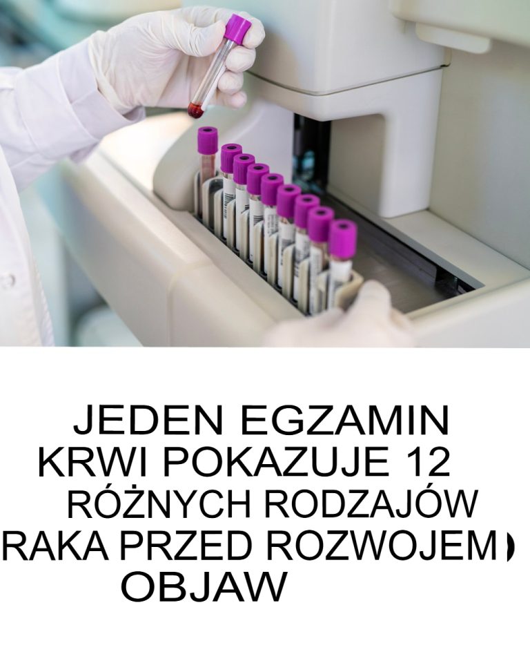 🧬 miONCO-Dx: badanie krwi wykrywające 12 nowotworów, zanim pojawią się objawy