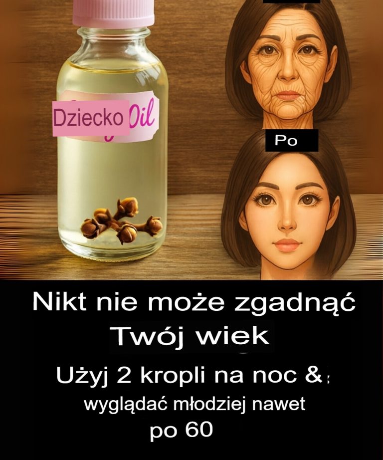 Korzyści z goździków dla skóry – olejek goździkowy, żel goździkowy i kostki lodu goździkowego