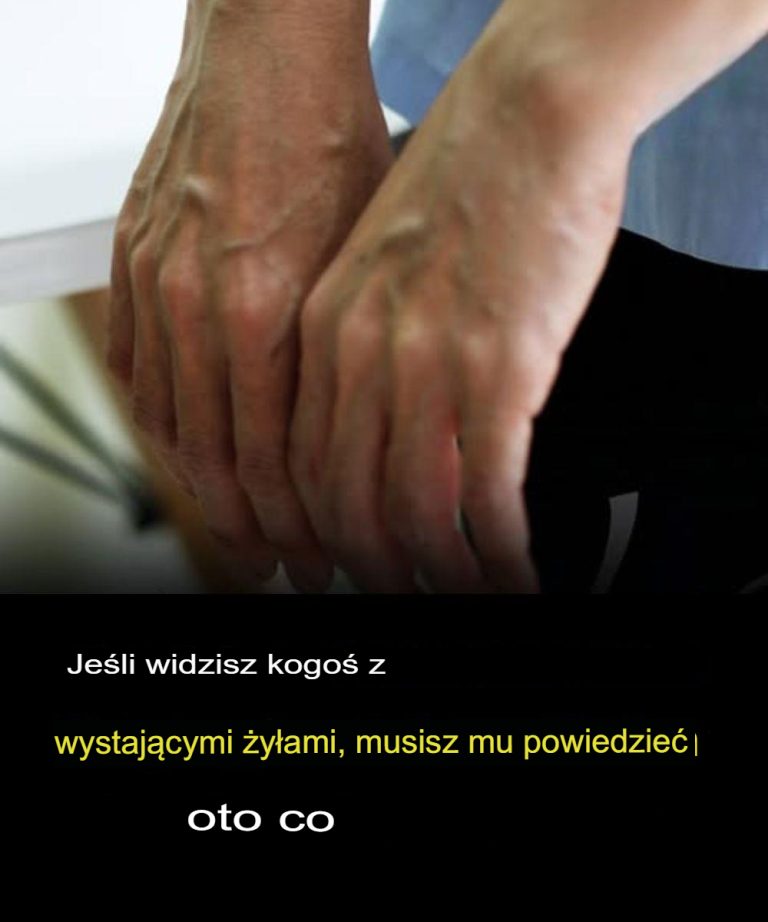7 codziennych nawyków, które powodują, że Twoje żyły stają się bardziej nabrzmiałe