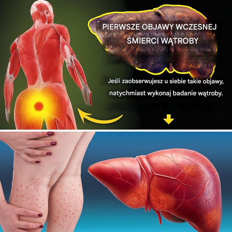 Myślisz, że jesteś zdrowy? Ale Twoja wątroba może mieć inne zdanie… Nie ignoruj ​​tych 12 ukrytych sygnałów ostrzegawczych!