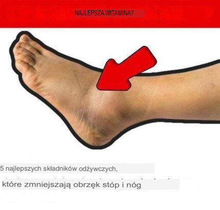 5 najlepszych produktów spożywczych zmniejszających obrzęk stóp i nóg