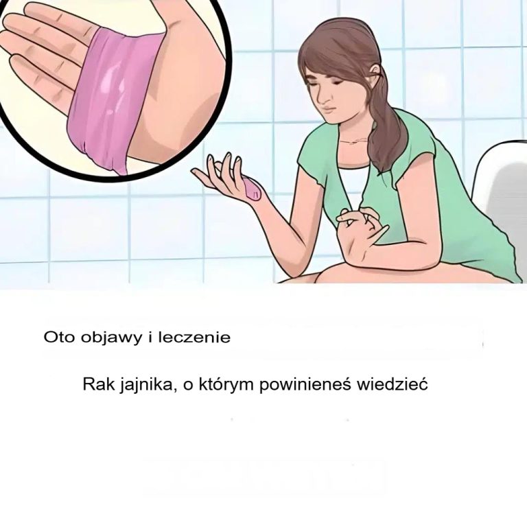 Rak jajnika: Oto najczęstsze wczesne objawy