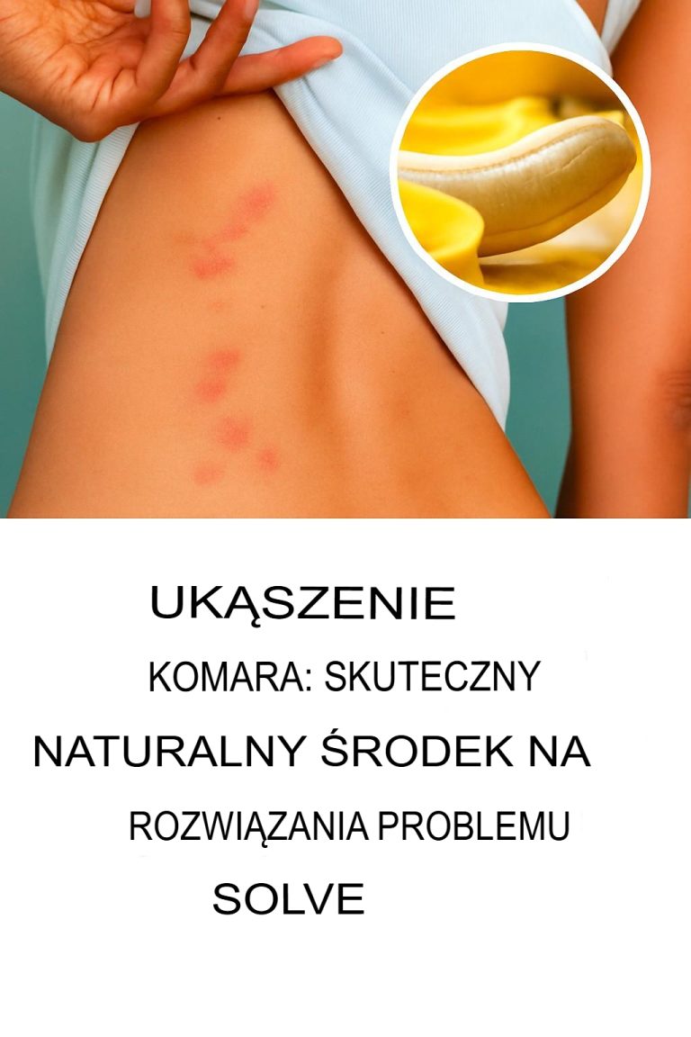Ukąszenia komarów: Skuteczny naturalny sposób na rozwiązanie problemu